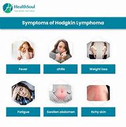 Image result for Hodgkin Lymphoma Cancer Symptoms