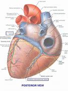 Image result for Posterior Interventricular Sulcus