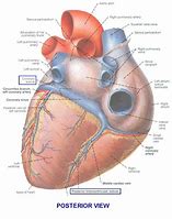 Image result for Atrioventricular Coronary Sulcus