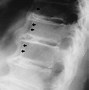 Image result for X-ray Bone Soft Tissue