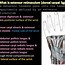 Image result for Flexor Retinaculum of the Hand Function