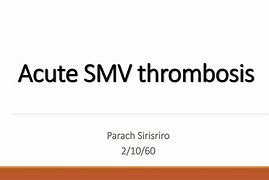 Image result for SCV Thrombosis