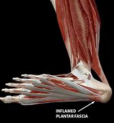 Image result for Plantar Arch of Foot