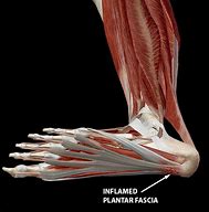 Image result for Foot Anatomy Plantar Arch