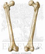 Image result for Femur Osteology