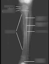 Image result for Long Skinny Bone Identifacation