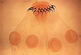 Image result for Human Parasites