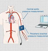 Image result for Pressure Illustration