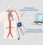 Image result for Blood Pressure Illustration