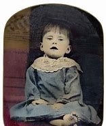 Image result for Post-Mortem Mother and Child