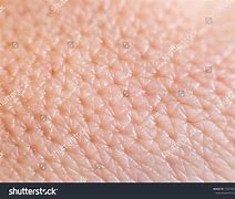 Image result for Macro Skin Pores