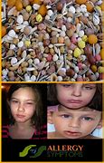 Image result for Brazil Nut Allergy Symptoms