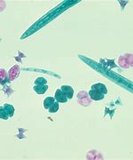 Image result for Algae Microscope Slides