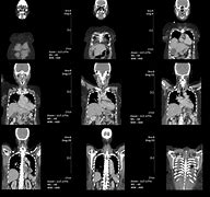 Image result for Full-Body CT Scan