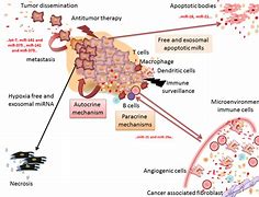 Image result for Exosome Tumor