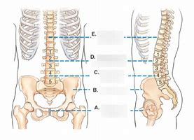 Image result for Lumbar Spine Anatomical Landmarks