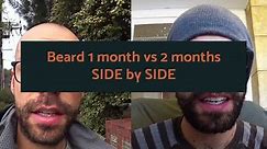 Beard 1 month vs 2 months [side by side comparison]