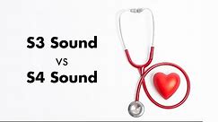 S3 vs S4 Heart Sound