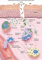 Image result for E Inflamed Tissue