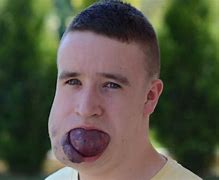 Image result for Big Ounce Tumor