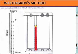 Image result for ESR Procedure