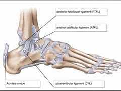 Image result for Lateral Malleolus Ligaments