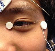 Image result for Erg Eye Dtl