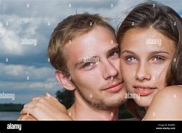 Image result for Cheek Arch