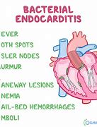 Image result for Acute Endocarditis