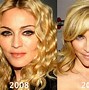 Image result for Madonna Today Plastic Surgery