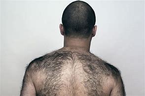 Image result for Hair On Back