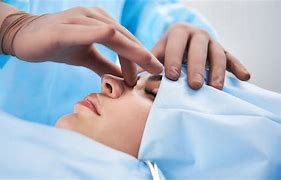 Image result for Sleep Apnea Surgery