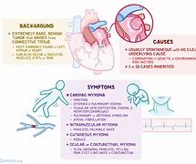 Image result for Cardiac Myxoma