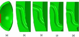 Image result for Long Tunnel Ureter