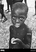 Image result for Starving Babies in Africa