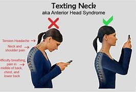 Image result for Head and Neck Posture