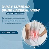 Image result for Lumbar Spine Side View