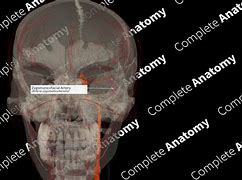 Image result for Zygomaticofacial Artery Hematoma