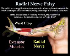 Image result for Radial Nerve in Hand