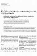 Image result for Right Atrial Appendage Aneurysm