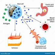 Image result for Histamine Reaction