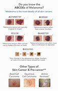 Image result for 5 Warning Signs of Skin Cancer