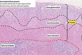 Image result for Adrenal Cortex Histology