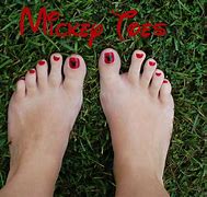 Image result for MSM Boskus Toes