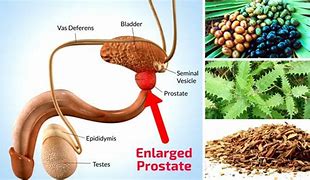 Image result for Prostate Pills