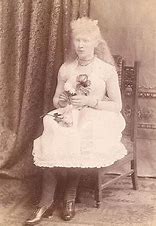 Image result for Albino Lady