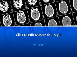 Image result for CT Scan Image for PPT