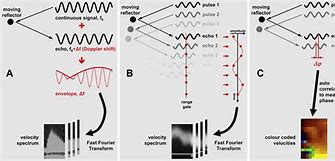 Image result for Continuous Wave Doppler Ultrasound