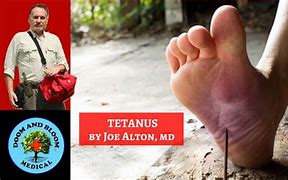 Image result for Rusty Nail Tetanus