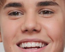 Image result for Jaemin Braces